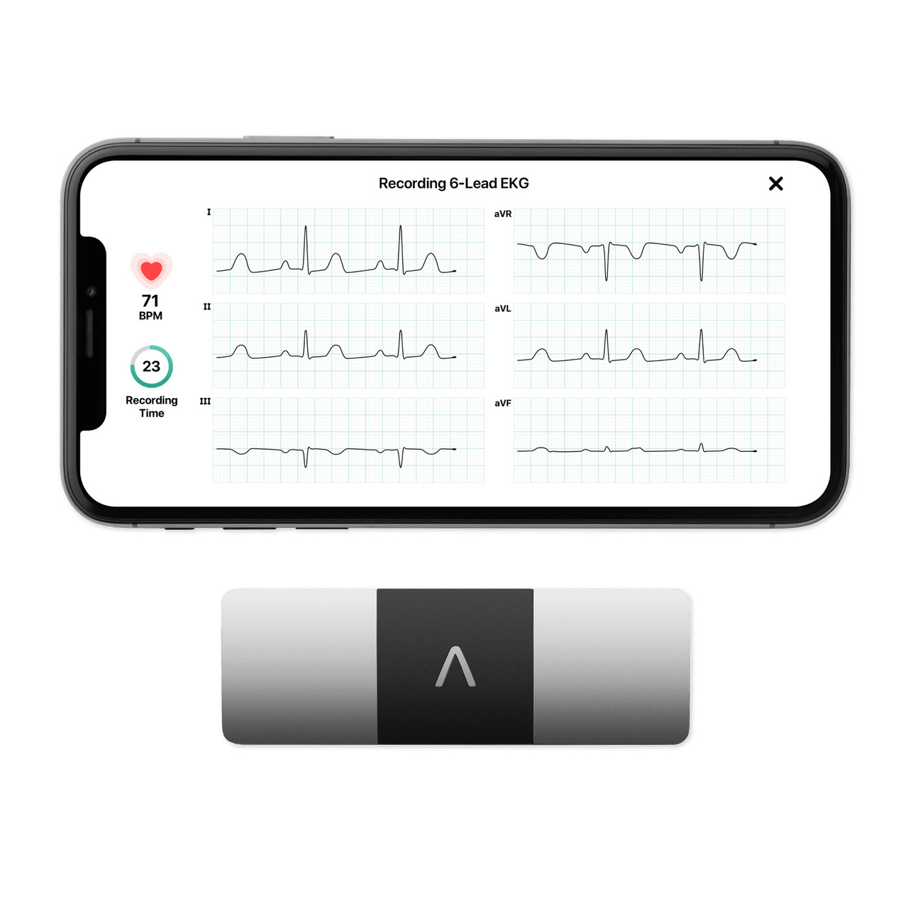 KardiaMobile 6L device beside a phone displaying an ECG