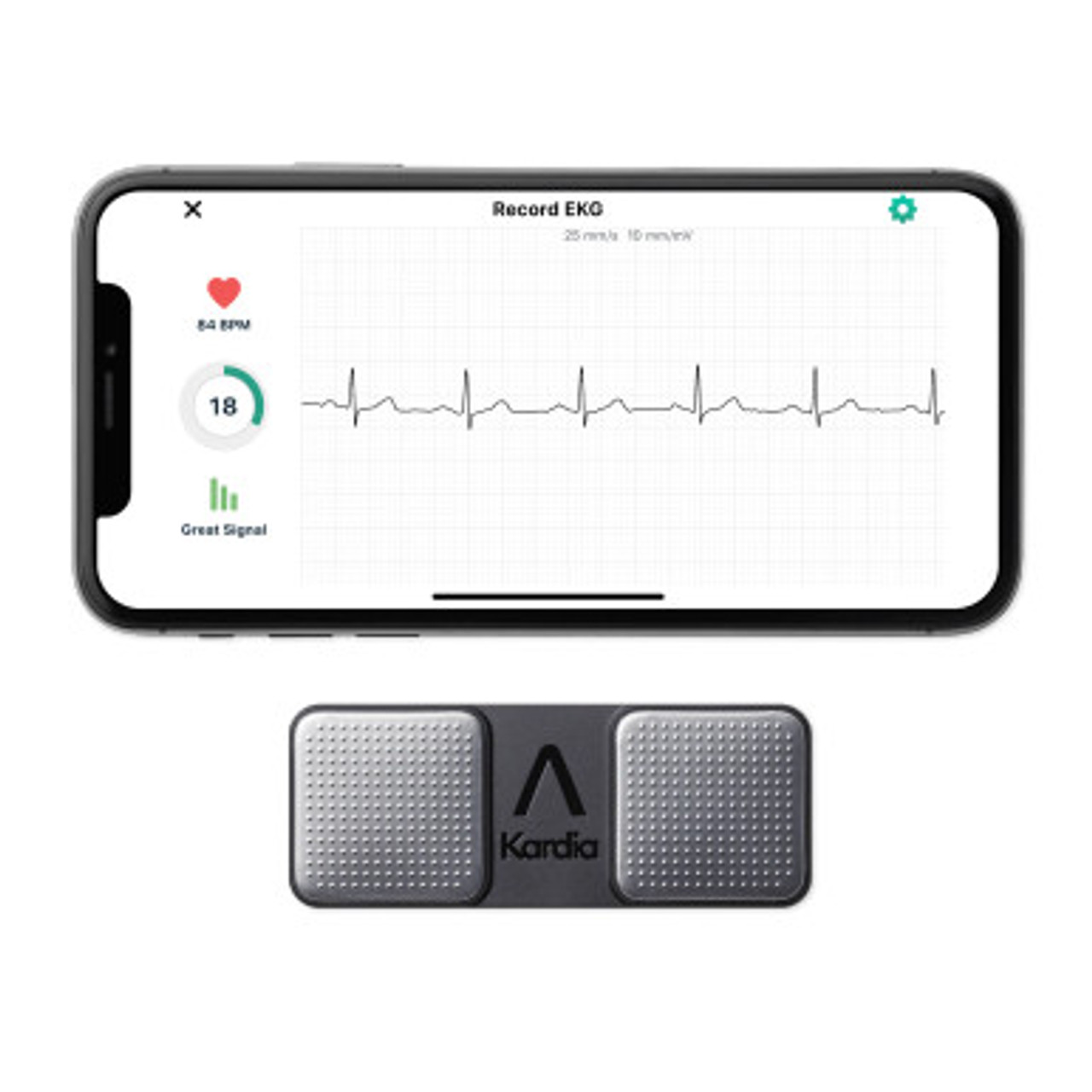KardiaMobile device beside a phone displaying an ECG